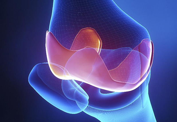 a bokaízület deformáló artrózisának tünetei 1 fok ízületi őssejtek